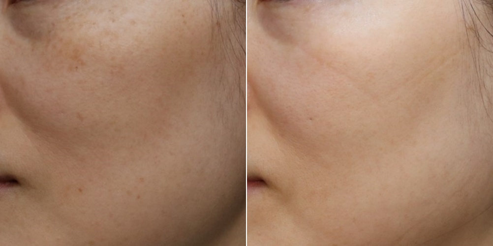 은평구피부과 프리즘클리닉