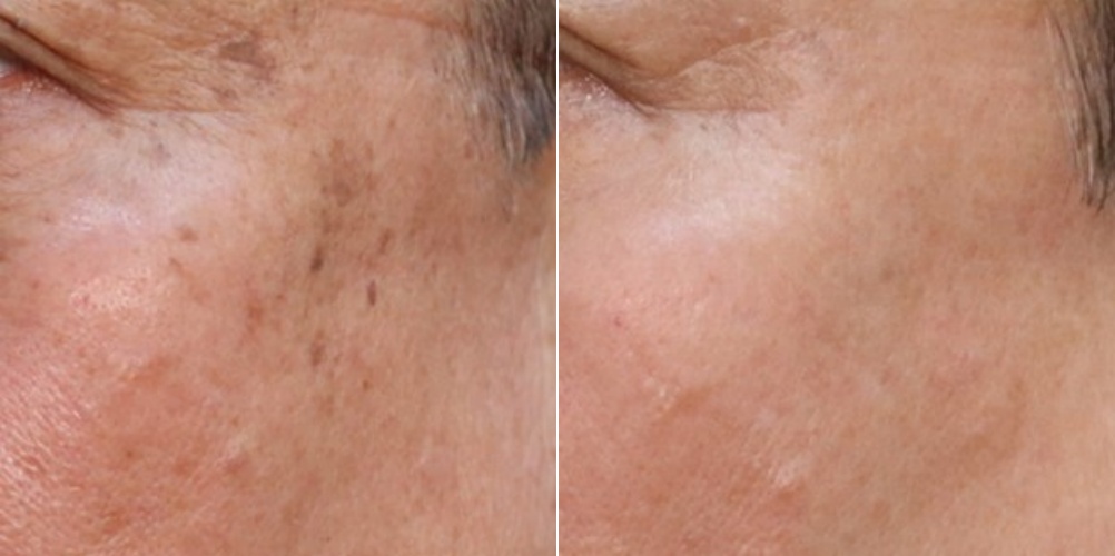 은평구피부과 프리즘클리닉