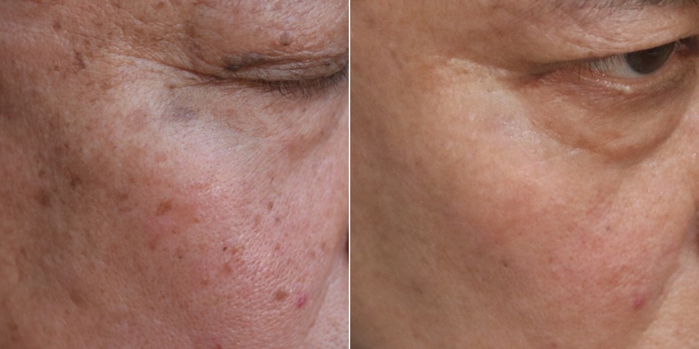 은평구피부과 프리즘클리닉