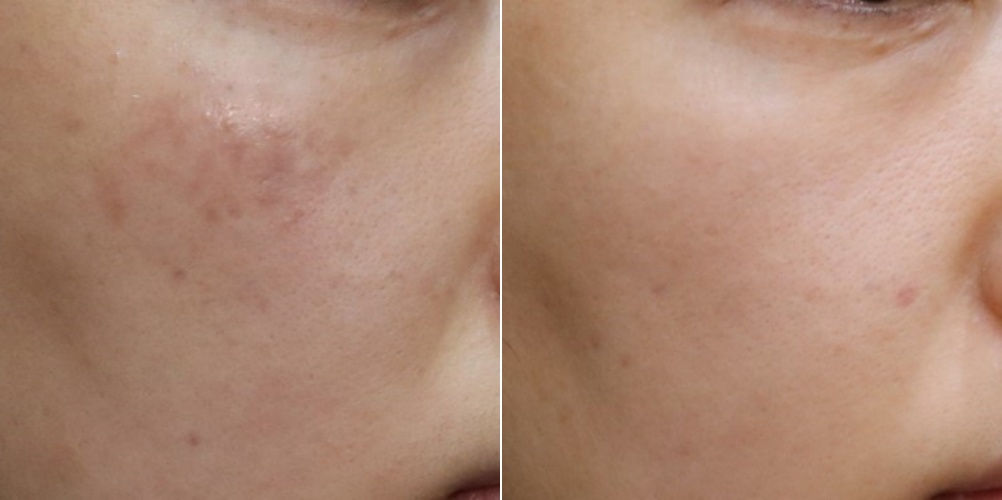 은평구피부과 프리즘클리닉