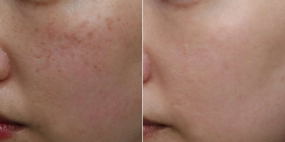 은평구피부과 프리즘클리닉