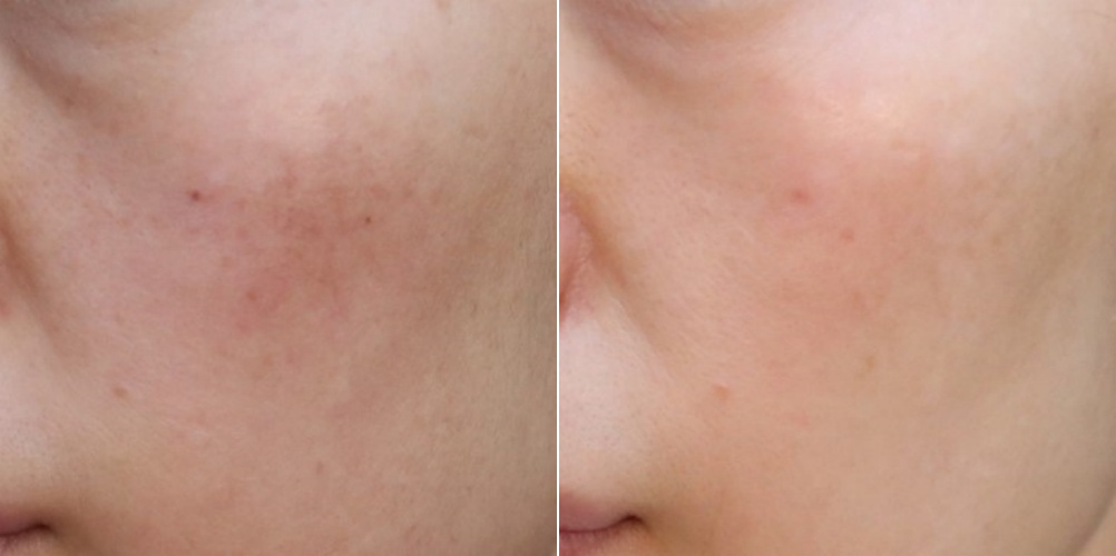 은평구피부과 프리즘클리닉